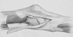 The Influence of Joint Alignment on Posture and Musculoskeletal Health Over Time